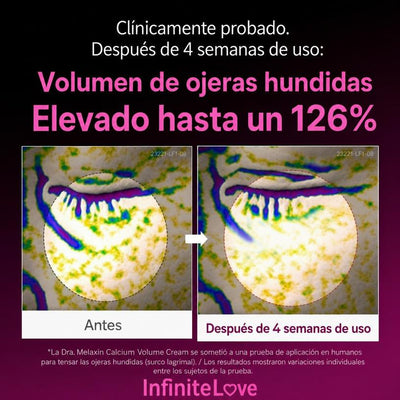 Ashley Calcium — Crema de Volumen Facial Calcio Iónico 10.000 ppm · 50 ml